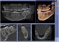 pi_orthophos_xg_3d_genauere_diagnose_t2_196.jpg