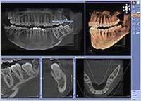 pi_orthophos_xg_3d_genauere_diagnose_t2_196.jpg